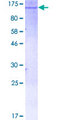 HK1 / Hexokinase 1 Protein - 12.5% SDS-PAGE of human HK1 stained with Coomassie Blue