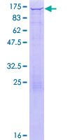 HK1 / Hexokinase 1 Protein - 12.5% SDS-PAGE of human HK1 stained with Coomassie Blue