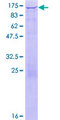 HK1 / Hexokinase 1 Protein - 12.5% SDS-PAGE of human HK1 stained with Coomassie Blue