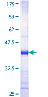 HK1 / Hexokinase 1 Protein - 12.5% SDS-PAGE Stained with Coomassie Blue.