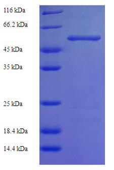 HK1 / Hexokinase 1 Protein