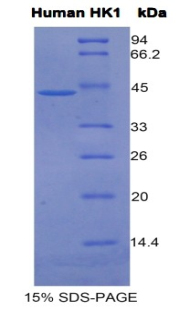 HK1 / Hexokinase 1 Protein - Recombinant Hexokinase 1 By SDS-PAGE