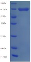 HK1 / Hexokinase 1 Protein