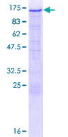 HK2 / Hexokinase 2 Protein - 12.5% SDS-PAGE of human HK2 stained with Coomassie Blue