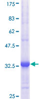 HK2 / Hexokinase 2 Protein - 12.5% SDS-PAGE Stained with Coomassie Blue.