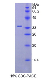 HK2 / Hexokinase 2 Protein - Recombinant Hexokinase 2 By SDS-PAGE