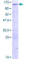 HK3 / Hexokinase 3 Protein - 12.5% SDS-PAGE of human HK3 stained with Coomassie Blue