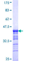 HK3 / Hexokinase 3 Protein - 12.5% SDS-PAGE Stained with Coomassie Blue.