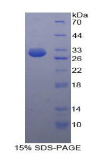 HK3 / Hexokinase 3 Protein - Recombinant Hexokinase 3, White Cell By SDS-PAGE