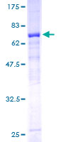 HKDC1 Protein - 12.5% SDS-PAGE of human FLJ22761 stained with Coomassie Blue