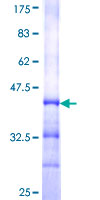 HKDC1 Protein - 12.5% SDS-PAGE Stained with Coomassie Blue.
