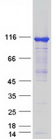 HKDC1 Protein - Purified recombinant protein HKDC1 was analyzed by SDS-PAGE gel and Coomassie Blue Staining