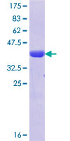 HKR1 Protein - 12.5% SDS-PAGE Stained with Coomassie Blue.