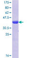 HKR1 Protein - 12.5% SDS-PAGE Stained with Coomassie Blue.