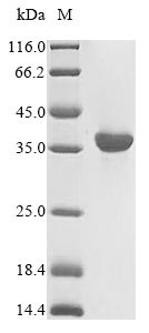 HLA-A Protein - (Tris-Glycine gel) Discontinuous SDS-PAGE (reduced) with 5% enrichment gel and 15% separation gel.