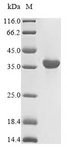 HLA-A Protein - (Tris-Glycine gel) Discontinuous SDS-PAGE (reduced) with 5% enrichment gel and 15% separation gel.