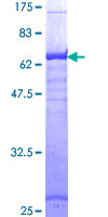 HLA-A Protein - 12.5% SDS-PAGE of human HLA-A stained with Coomassie Blue