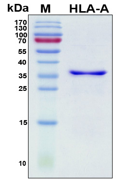 HLA-A Protein