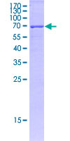 HLA-C Protein - 12.5% SDS-PAGE of human HLA-C stained with Coomassie Blue