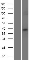 HLA Class I Histocompatibility Antigen, B-27 Alpha Chain Precursor (HLA-B) Protein - Western validation with an anti-DDK antibody * L: Control HEK293 lysate R: Over-expression lysate