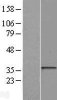 HLA-DOA Protein - Western validation with an anti-DDK antibody * L: Control HEK293 lysate R: Over-expression lysate