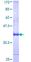 HLA-DOB Protein - 12.5% SDS-PAGE Stained with Coomassie Blue.