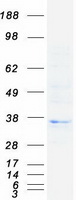 HLA-DOB Protein - Purified recombinant protein HLA-DOB was analyzed by SDS-PAGE gel and Coomassie Blue Staining