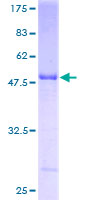 HLA-DPB1 Protein - 12.5% SDS-PAGE of human HLA-DPB1 stained with Coomassie Blue