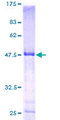 HLA-DPB1 Protein - 12.5% SDS-PAGE of human HLA-DPB1 stained with Coomassie Blue
