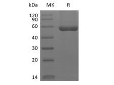 Hla-dqa1 gene (dqa1*0201, dqa1*03011 and dqa1*0303) Protein - Recombinant Human HLA-A*0201 WT-1 complex Protein (C-10His)