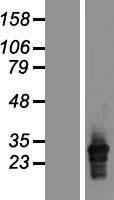 HLA-DQA2 Protein - Western validation with an anti-DDK antibody * L: Control HEK293 lysate R: Over-expression lysate