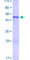 HLA-DQB1 Protein - 12.5% SDS-PAGE of human HLA-DQB1 stained with Coomassie Blue