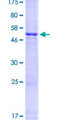 HLA-DQB1 Protein - 12.5% SDS-PAGE of human HLA-DQB1 stained with Coomassie Blue