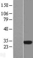 HLA-DRA Protein - Western validation with an anti-DDK antibody * L: Control HEK293 lysate R: Over-expression lysate