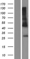 HLA-DRB1 Protein - Western validation with an anti-DDK antibody * L: Control HEK293 lysate R: Over-expression lysate