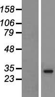 HLA-DRB5 Protein - Western validation with an anti-DDK antibody * L: Control HEK293 lysate R: Over-expression lysate