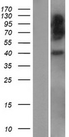 HLA-E Protein - Western validation with an anti-DDK antibody * L: Control HEK293 lysate R: Over-expression lysate