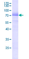 HLA-E Protein - 12.5% SDS-PAGE Stained with Coomassie Blue