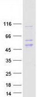HLA-E Protein - Purified recombinant protein HLA-E was analyzed by SDS-PAGE gel and Coomassie Blue Staining
