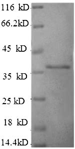 HLA-G Protein - (Tris-Glycine gel) Discontinuous SDS-PAGE (reduced) with 5% enrichment gel and 15% separation gel.