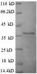 HLA-G Protein - (Tris-Glycine gel) Discontinuous SDS-PAGE (reduced) with 5% enrichment gel and 15% separation gel.