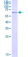 HLA-G Protein - 12.5% SDS-PAGE of human HLA-G stained with Coomassie Blue