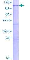 HLCS / HCS Protein - 12.5% SDS-PAGE of human HLCS stained with Coomassie Blue