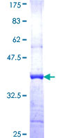 HLCS / HCS Protein - 12.5% SDS-PAGE Stained with Coomassie Blue.