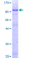 HLX1 / HLX Protein - 12.5% SDS-PAGE of human HLX1 stained with Coomassie Blue