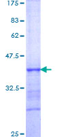 HLX1 / HLX Protein - 12.5% SDS-PAGE Stained with Coomassie Blue.