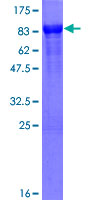 HMBOX1 Protein - 12.5% SDS-PAGE of human FLJ21616 stained with Coomassie Blue