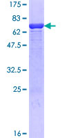 HMBS / PBGD Protein - 12.5% SDS-PAGE of human HMBS stained with Coomassie Blue
