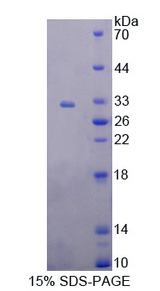 HMBS / PBGD Protein - Recombinant  Hydroxymethylbilane Synthase By SDS-PAGE