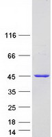 HMCES / C3orf37 Protein - Purified recombinant protein HMCES was analyzed by SDS-PAGE gel and Coomassie Blue Staining